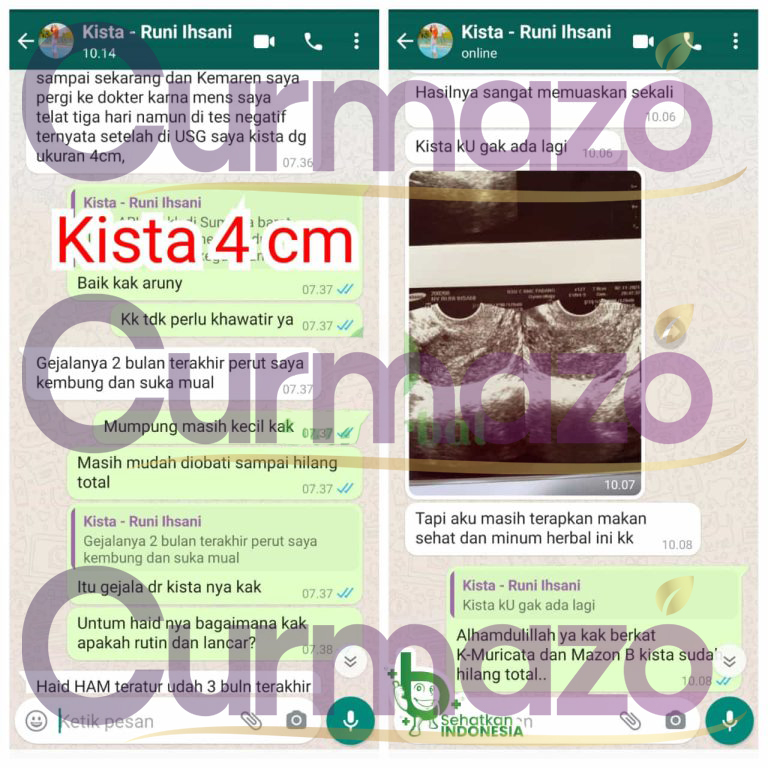 Runi-copy